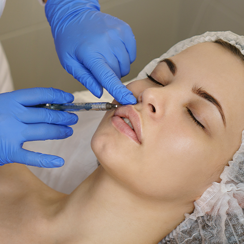 UPPER LIP LIFT SURGERY