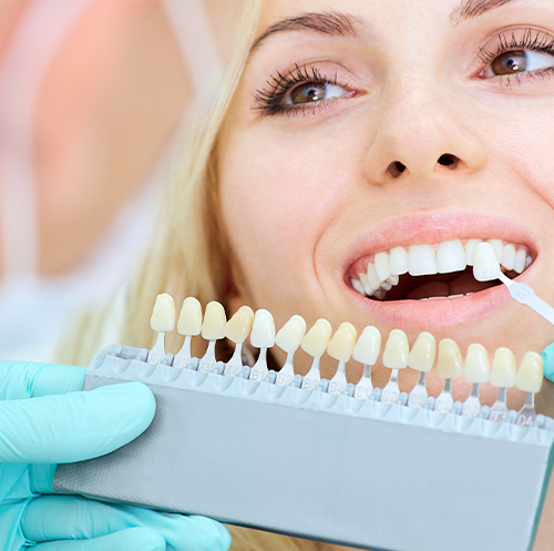 DENTAL IMPLANTS
