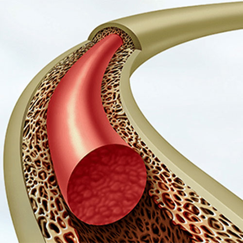 ADULT AND PEDIATRIC BONE MARROW TRANSPLANTATION